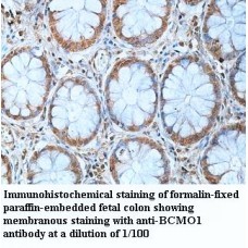 BCMO1 Antibody