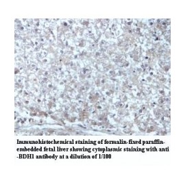 BDH1 Antibody