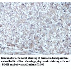 BDH1 Antibody