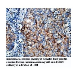 BEND5 Antibody