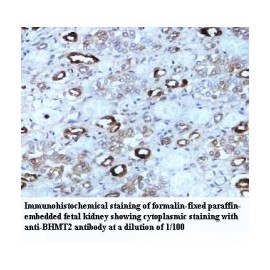 BHMT2 Antibody
