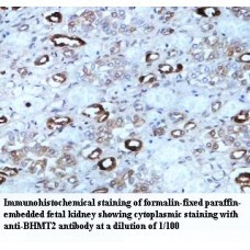BHMT2 Antibody