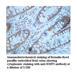 BMP3 Antibody