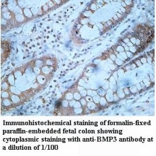 BMP3 Antibody