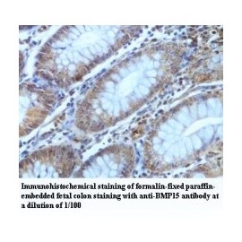 BMP15 Antibody