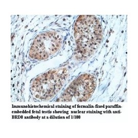 BRD8 Antibody