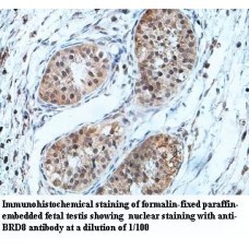 BRD8 Antibody