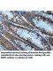 BRIP1 Antibody