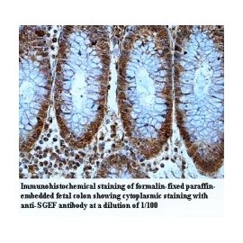 SGEF Antibody