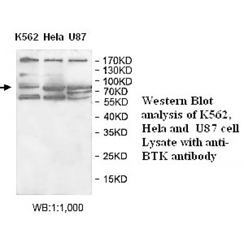 BTK Antibody