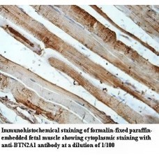 BTN2A1 Antibody
