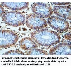 BTNL8 Antibody