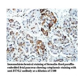 BTNL2 Antibody