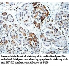 BTNL2 Antibody
