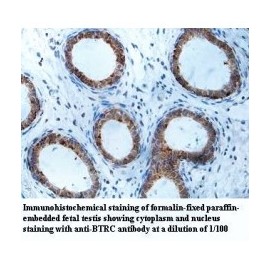BTRC Antibody