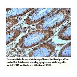 RICH2 Antibody