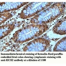 RICH2 Antibody