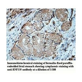 RNF135 Antibody