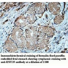 RNF135 Antibody