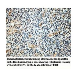 RNF19B Antibody