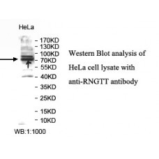 RNGTT Antibody