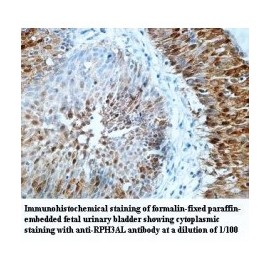 RPH3AL Antibody