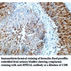 RPH3AL Antibody
