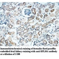 RPL18A Antibody