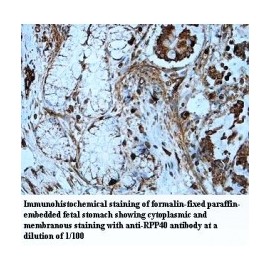 RPP40 Antibody