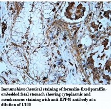 RPP40 Antibody