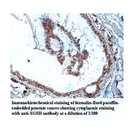 SGSH Antibody