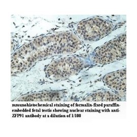 ZFP91 Antibody