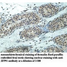 ZFP91 Antibody