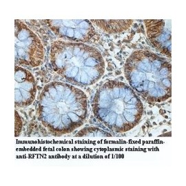 RFTN2 Antibody
