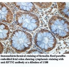 RFTN2 Antibody