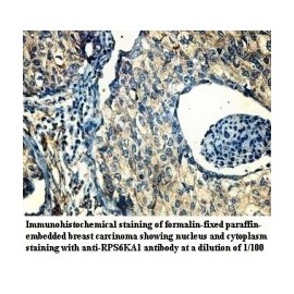 RPS6KA1 Antibody