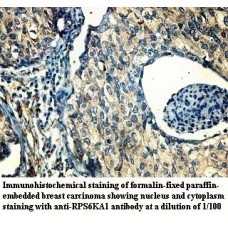 RPS6KA1 Antibody