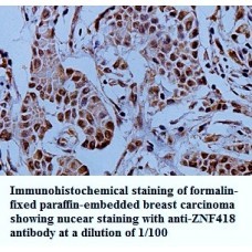 ZNF418 Antibody