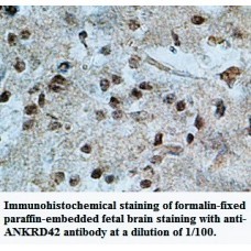 ANKRD42 Antibody