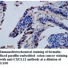 CXCL12 Antibody