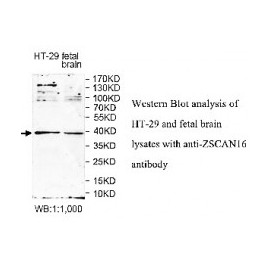 ZSCAN16 Antibody