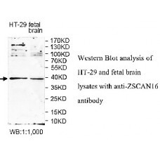 ZSCAN16 Antibody