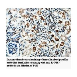 RNF183 Antibody