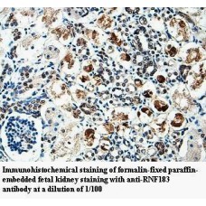 RNF183 Antibody