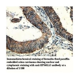 RPS6KA3 Antibody