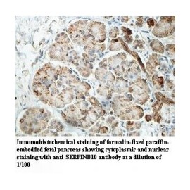 SERPINB10 Antibody