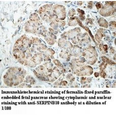 SERPINB10 Antibody