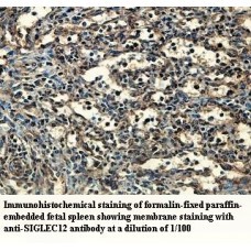 SIGLEC12 Antibody
