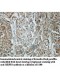 SIRPB1 Antibody