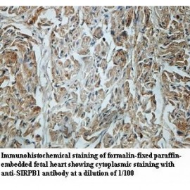 SIRPB1 Antibody